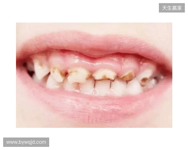 韦林顿确诊上唇部贯通伤；11、21牙半脱位；上颌前牙区牙槽骨骨折